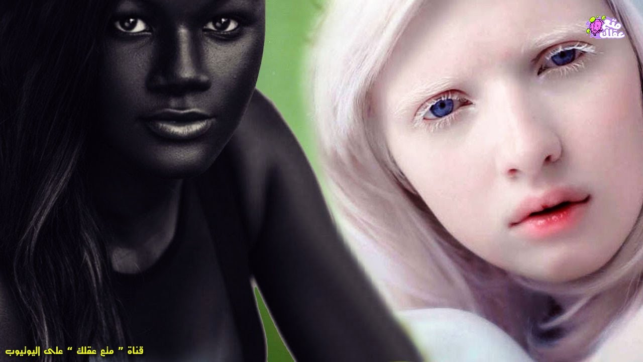 5 فتيات يمتلكن أغرب لون بشرة فى العالم !