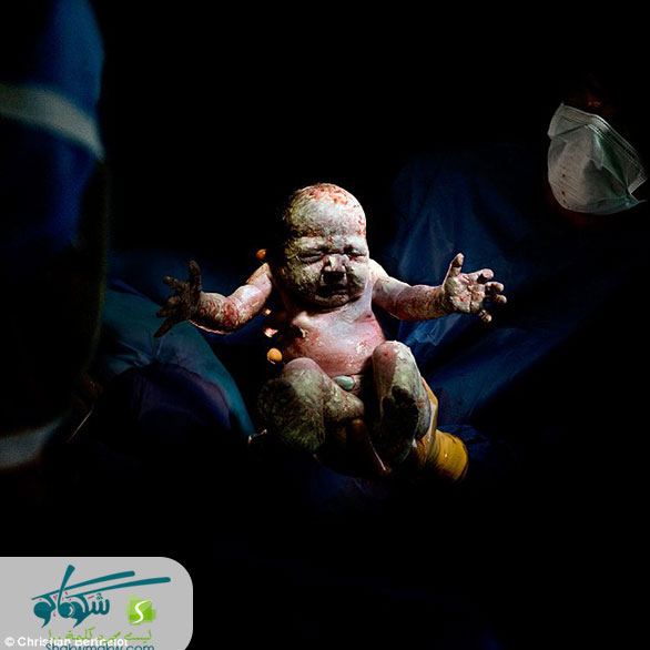 صور | لقطات مؤثرة للحظة ولادة الأطفال